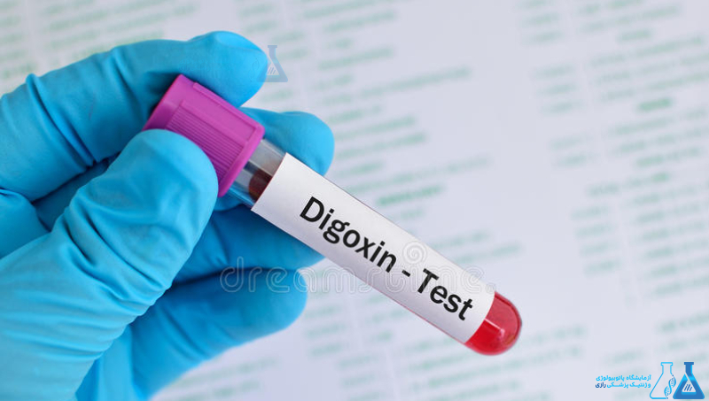 آزمایش Digoxin